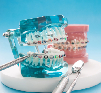 Orthodontics